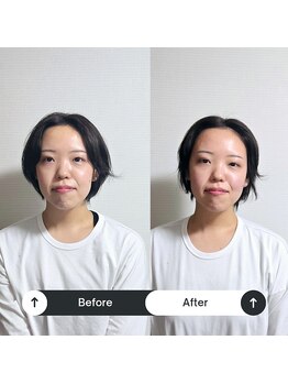 サニー(SUNNY)/小顔矯正変化3