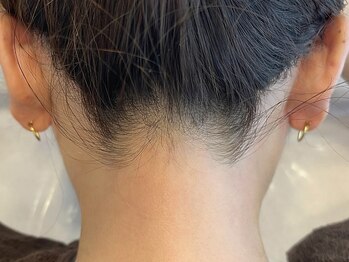 はなさくら【白髪脱毛・ワックス・美容脱毛】あざみ野店の写真/VIO・うなじ・もみあげ・眉周りなど細かい部位もお任せ!ワックス/美容脱毛/電気脱毛であらゆる毛質に対応。