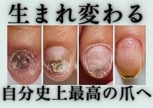 ヴェールリム(verl lim)