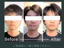 ビーレ袋町/[小顔矯正]男性も歪みを整え小顔