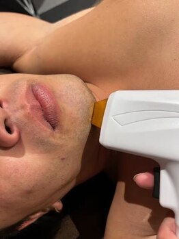 クロス(cross)/抜けにくい産毛や白髪もお任せ