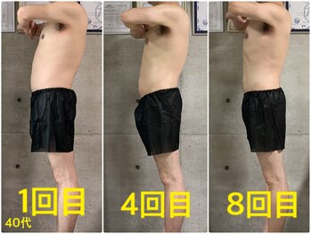 ペリー(PELLY)/男性40代 before after