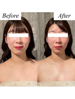 グレースフィオーレ 上野御徒町店(gracefiore)/ビフォーアフター