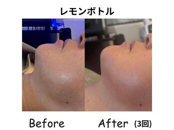 ラディアント たまプラーザ/《レモンボトル》