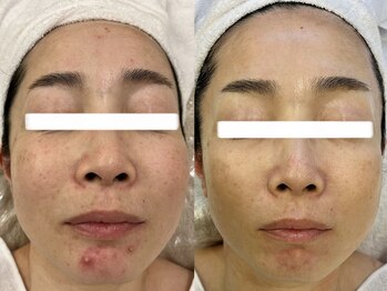 ナポデイズ(NAPODAYS)