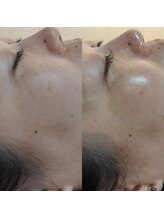 ビーマジック(Be Magic)/乾燥撃退！