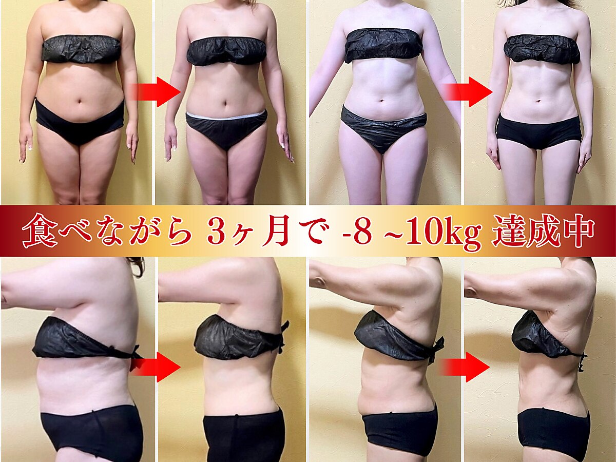 ビジュクイーン(BIJOU QUEEN)｜ホットペッパービューティー