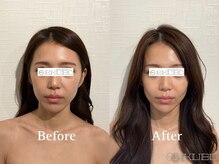 エクボ 立川店(EKUBO)の雰囲気（劇的な変化で、やみつきに♪《立川/小顔/小顔矯正/輪郭/左右差》）