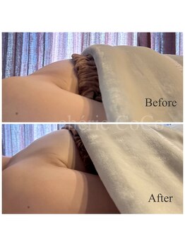 シェリーココ(cherie CoCo)/ブラを取ったら胸がない？