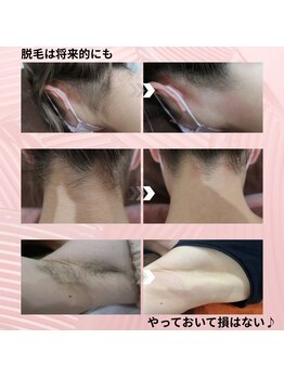 リヴェーヌ 呉羽店(Riverne)の写真/【脱毛歴20年以上のサロン】ベテランスタッフによる施術やアドバイスで脱毛・自己処理を卒業しましょう！