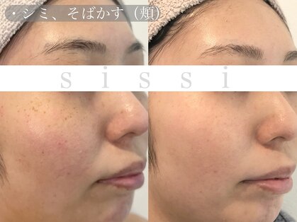 シシィ 二子玉川(sissi)の写真