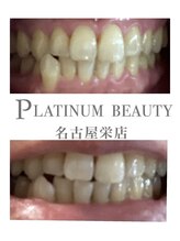 プラチナムビューティー 名古屋栄本店(PLATINUM BEAUTY)/お客様Before After
