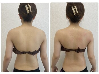 カウイ(KAUI)/背中・肩・腰回りがスッキリ！