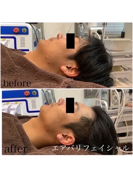 エムドット(M.)/令和メンズのエステ通いはマスト