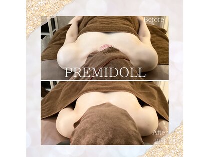 プレミドール(PREMIDOLL)のメインフォト01