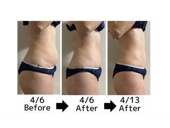 ウィッシュプロサロンケー(WISHpro salon K)/驚愕！たった2回でこの変化！