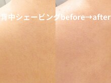 ももとゆでたまご/背中ブライダルケア