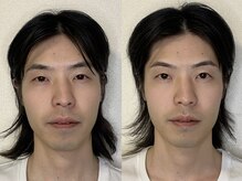 ナビレラ(navillera)/疲れ顔・顎歪み・余白