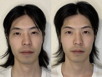 ナビレラ(navillera)/疲れ顔・顎歪み・余白