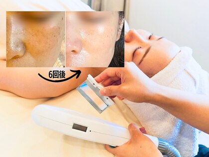 オリエンタルビューティー(ORIENTAL BEAUTY)の写真