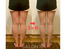 サロンアール(SALON R)/定期ケア/アドバイス実行で変化