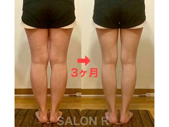 サロンアール(SALON R)/定期ケア/アドバイス実行で変化