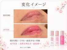 ハス(hasu.)/サロン施術+ホームケア使用