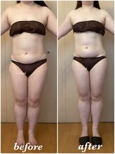 アンフィニ(infini)/短期集中コース9回目（3ヶ月）