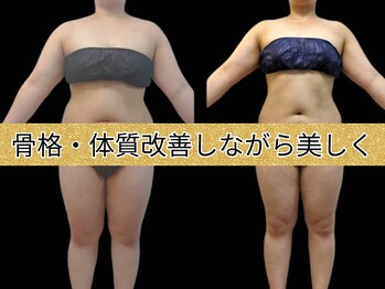 美骨痩身アンドデトックスサロン プティソンム 目黒