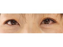 ジャポネスク(JAPONESQUE)/Cカール