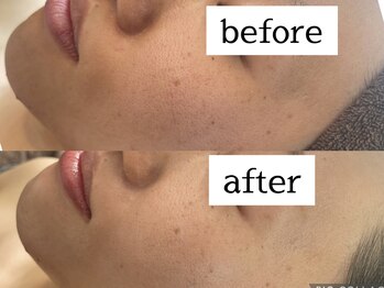 エスデザイン(es design)/ブライダル/鹿児島/花嫁