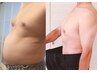 【メンズ限定】初回耳つぼ体験＋カウンセリング