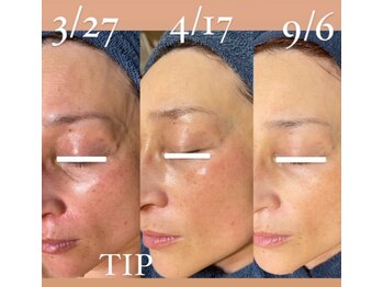 22クラレ(22curare)/エイジングケアにも無添加ハーブ