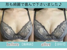 サラエクセレント 銀座/バストアップでカップ数ＵＰ♪