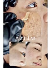 リアンドハリ(Rien’d Hari)/最新シミケアWHITE LAB 