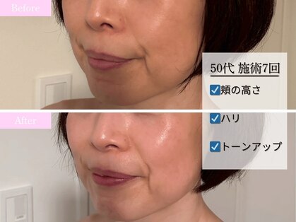 サブリエ(Sablier)の写真