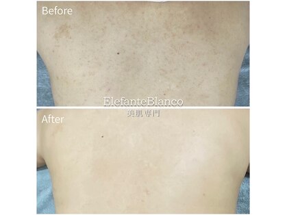 エレファンテブランコ(Elefante Blanco)の写真