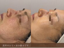 シャルル ストア 京都三条通(Chaleureux Store)の雰囲気（素肌が育まれ、繰り返しの起こらないより綺麗なお肌へ）