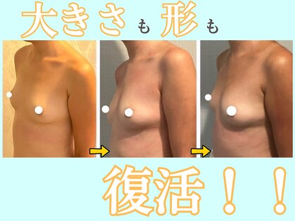 プレフィール(PLEAFEEL)の写真