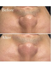 ホワイトワックス 京都四条烏丸(WHITE WAX)/《全顔》フェイシャルワックス