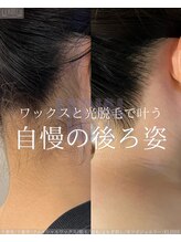 エリス(ELISSE)/ワックスと光脱毛で自慢の後ろ姿
