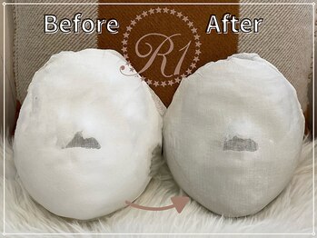 R-1ビューティーサロン 銀座/BEFORE＆AFTER