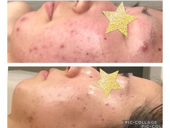 ボーテ(beaute)/【ビフォーアフター】