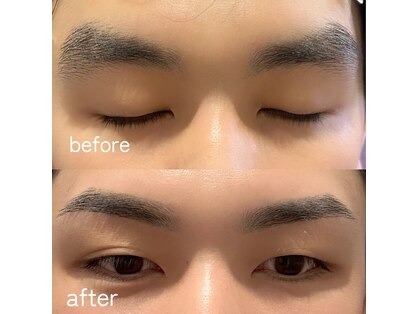 バルブ(BaREB)の写真