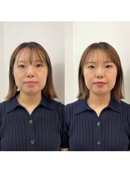 パーソナルサンフラワー(PersonalSunflower)/お客様ヘアメイク Before/After