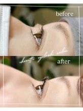 シュエット(chouette)/before/after