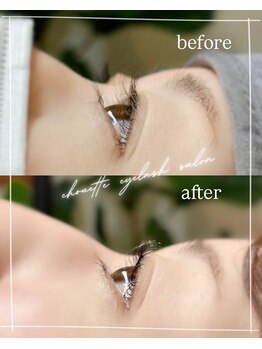 シュエット(chouette)/before/after