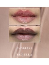 ミリノ(Salon MIRINO)/ルメラ♪唇