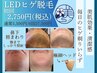 【メンズ脱毛】スピード20分　ヒゲ脱毛　1回¥3850