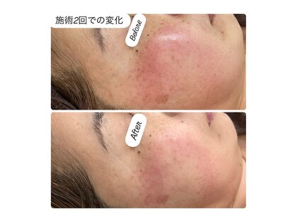 シンゲツ(SHINGETSU)の写真